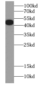 MNX1 antibody|MNX1抗体