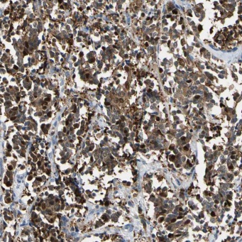 MAPK8 antibody|MAPK8抗体 FNab044