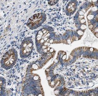 DNAH6 antibody|DNAH6抗体