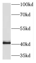 PRKX antibody|PRKX抗体