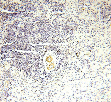 GDPD5 antibody|GDPD5抗体 FNab034