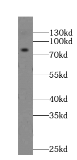 GPRIN3-Specific antibody|GPRIN