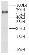 PANK1 antibody|PANK1抗体