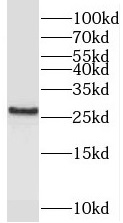 PEX11G antibody|PEX11G抗体