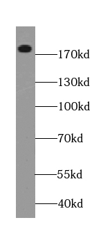 TOP2A-Specific antibody|TOP2A抗