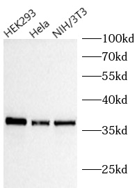 ANXA5 antibody|ANXA5抗体 FNab004