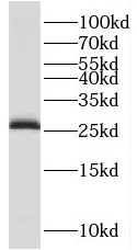 TPPP antibody|TPPP抗体 FNab08898