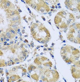 PMPCB antibody|PMPCB抗体