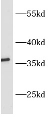 ASPRV1 antibody|ASPRV1抗体