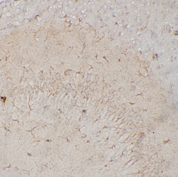 CPE antibody|CPE抗体 FNab10172