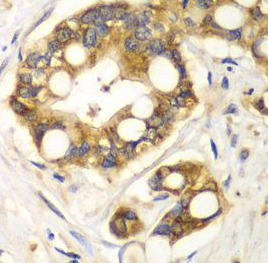 RPH3A antibody|RPH3A抗体