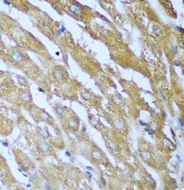 IGF2BP3 antibody|IGF2BP3抗体 FNa
