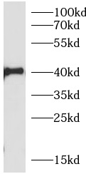 TNFAIP3 antibody|TNFAIP3抗体 FNa