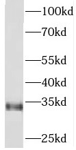 PITPNA antibody|PITPNA抗体