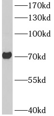 ASIC2 antibody|ASIC2抗体