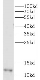 DDA1 antibody|DDA1抗体
