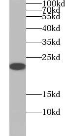 UBL4B antibody|UBL4B抗体