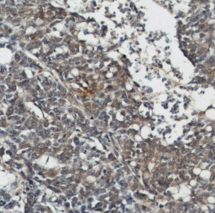 ALPL antibody|ALPL抗体 FNab00347