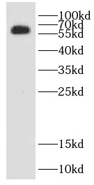 TKFC antibody|TKFC抗体