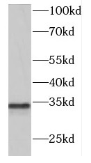 DNASE2 antibody|DNASE2抗体