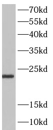 STMN2 antibody|STMN2抗体