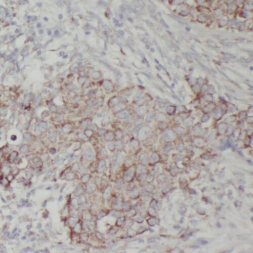 PPM1B antibody|PPM1B抗体