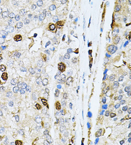 PNKP antibody|PNKP抗体