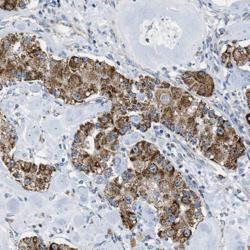 PEBP1 antibody|PEBP1抗体