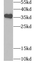 TPM2 antibody|TPM2抗体