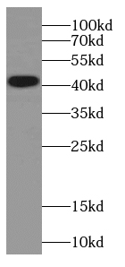 CKB antibody|CKB抗体