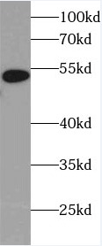 HPSE antibody|HPSE抗体 FNab04005