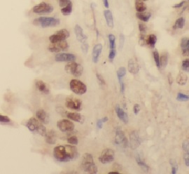 HDAC1 antibody|HDAC1抗体 FNab037