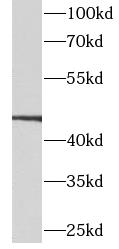 CALCRL antibody|CALCRL抗体