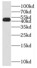 NIF3L1 antibody|NIF3L1抗体