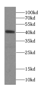 SEPTIN1 antibody|SEPTIN1抗体