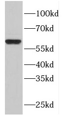 FBXW11 antibody|FBXW11抗体