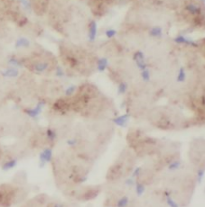 ST8SIA2-Specific antibody|ST8S