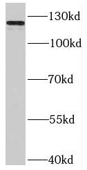 SLITRK3 antibody|SLITRK3抗体