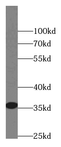 CLEC11A antibody|CLEC11A抗体 FNa