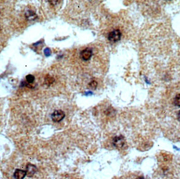 TRNAU1AP antibody|TRNAU1AP抗体