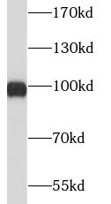 XPOT antibody|XPOT抗体