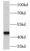 EGLN1 antibody|EGLN1抗体 FNab063