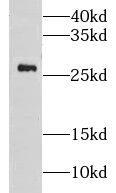 CMBL antibody|CMBL抗体