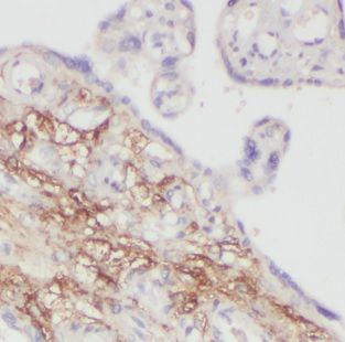 MAGED1 antibody|MAGED1抗体 FNab0