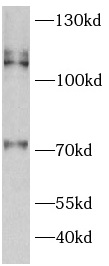 ATP2A2 antibody|ATP2A2抗体 FNab0