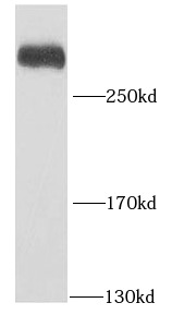 PRPF8 antibody|PRPF8抗体