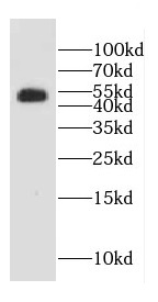 CDC25C antibody|CDC25C抗体