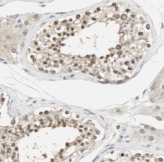 PPP3R2 antibody|PPP3R2抗体