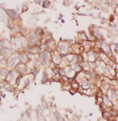 CLDN1 antibody|CLDN1抗体