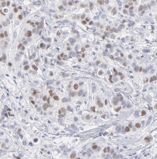 STAT2 antibody|STAT2抗体 FNab082